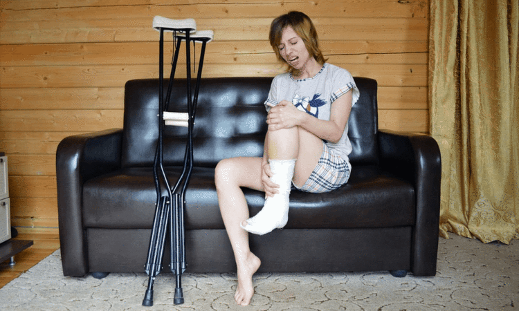 a lady with a fractured leg